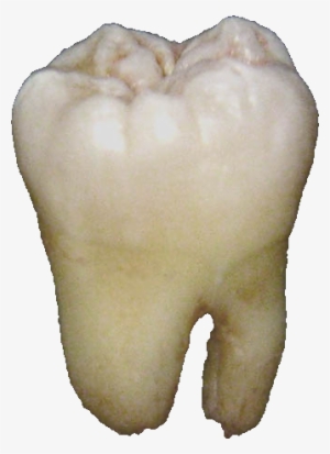 Lower Wisdom Tooth - Tooth Png