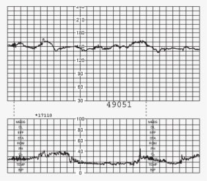 Normal Fetal Heart Rate Pattern - Monacor Airmt-85 Air Motion Transformers - Miscellaneous