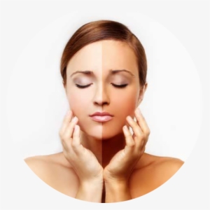 Laser Toning For Skin Lightening - Increase Melanin Production