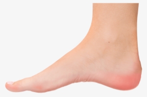 Milwaukee Plantar Fasciitis Foot - Transparent Foot Png