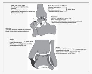 Graphic Library Stock Arrows Drawing Bone - Posterior Talofibular Ligament