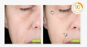 Neutratone Introductory Anti-aging Regimen Miracle - Eye Wrinkle Filler