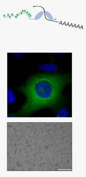 "gotas Líquidas " De Cpeb4en El Citoplasma Celular - Circle
