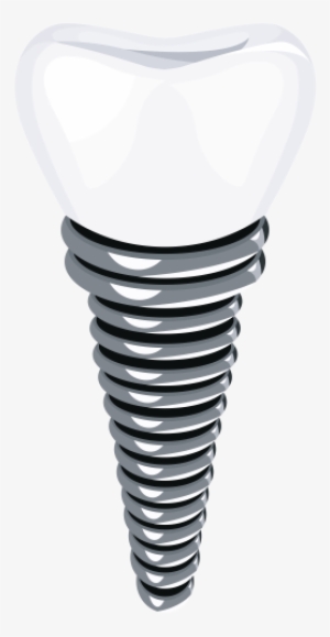Dental Implant Png Clip Art - Implant Png