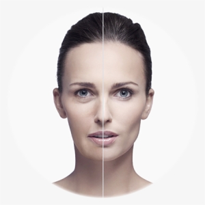 Facial Flaccidity
