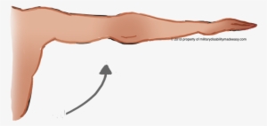 Shoulder Muscle 6 - Arm Atrophy