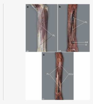 Palmaris Longus Muscle