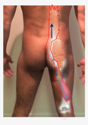 Deep Longitudinal Sling - Deep Longitudinal System