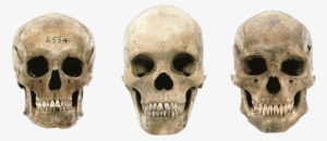 Variations In Modern Human Skulls - German Male Skull