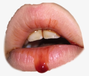 Blood Sad Death Spooky Sad Lips Teeth - Death
