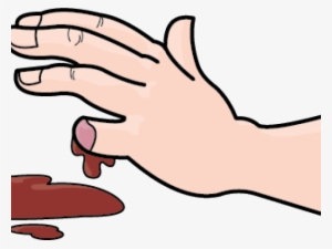 Wound Clipart Bleeding Kansas - Bleeding