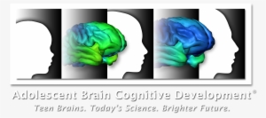 Logo Abcd Ondark Lg - Brain