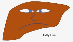 Non-alcoholic Fatty Liver Disease