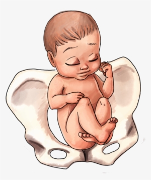 Breech Baby Position - Childbirth