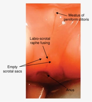 External Genital Development Of A Female Spotted Hyena - Clitoris Developing