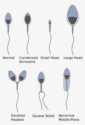 Regarding Sperm Morphology - Horse Sperm Cell