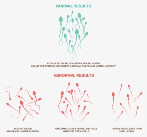 Teratospermia/ Teratozoospermia Might Perhaps Be The - 精蟲 活動 力