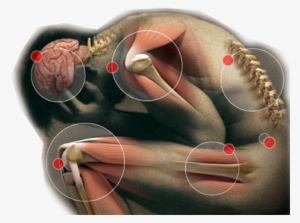 Its Effectiveness To Reduce Acupuncture For Pain - Somatization Disorder