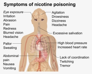 Symptoms Of Nicotine Poisoning - Nicotine Poisoning