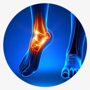 Foot & Ankle Condition - Foot And Ankle