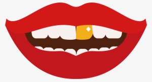 Tooth Gold Teeth Clip Art - Gold Tooth Clipart Transparent