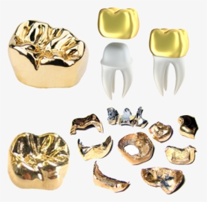 Gold Teeth Caps We Buy Gold Salem - Gold Crown Tooth