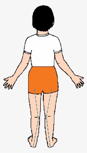"over Pronation" Means That, As Your Child Walks They - Illustration