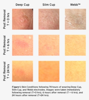 You Can See In The Picture Of Their Results, That The - Tile