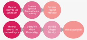 Vaginal Dryness Cure With Laser In Montreal - Montreal