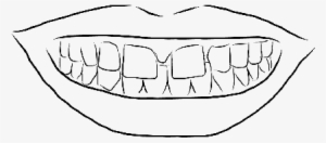 Gap-toothed Smile - Smile With Teeth Outline