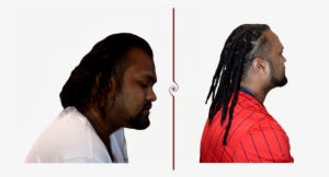 Neil Loc Extensions Before And After - Dreadlocks