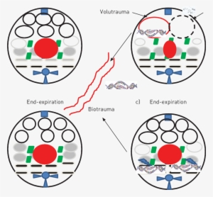 A) The Distribution Of Normally Aerated (white Circles), - Prone Ventilation