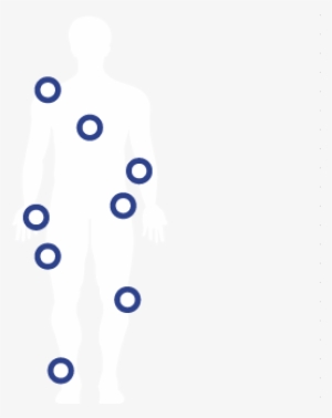 Muscle & Nervous System Conditions - Infografik Multiple Sklerose