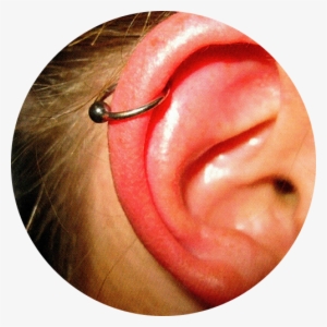 Helix Piercing - My Cartilage Piercing Infected