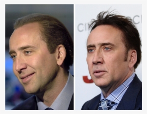 Nicolas Cage, 2001 Vs - Celebrity Men With Hair Pieces