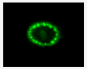And This Is How The Type 2 Supernova Explosion Occurs - Supernova 1987a
