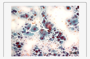 Nucleus And Nucleolus Criteria - Nucleolus