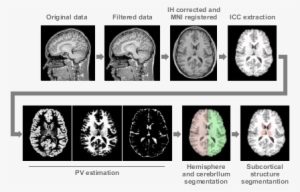 However This Time Can Vary Depending On The Number - Computed Tomography