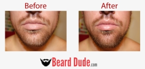 Before After Front - 7 Dywizjon Artylerii Konnej