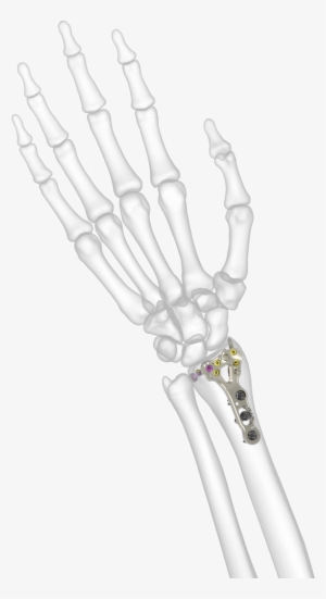 Acu Loc 2 - Skeleton Hi Res Arm