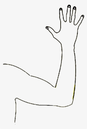 Svg Library Download Broken Arm Clipart - Arm Outline