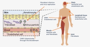 06 Pm 61359 Clinical Manifestation - Diagram