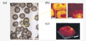 A Thin Blood Smear Of The Trophozoite Infected Erythrocytes - Near Field Scanning Optical Microscopy Amazing