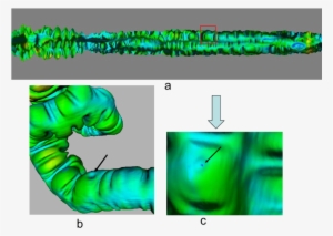 The Part Included In Red Square Indicates The Polyp - Polyp - 850x638 ...