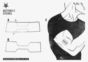 Butterfly Closure A - Diagram