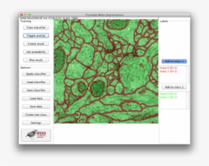 Deep Learning Segmentation Gui