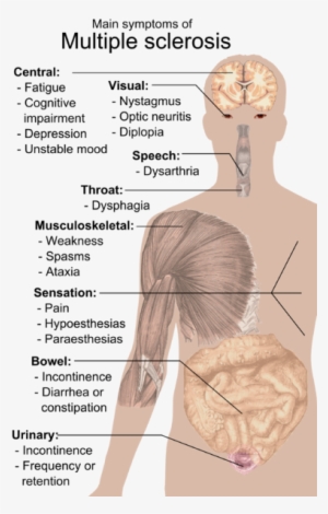 “main Symptoms Of Multiple Sclerosis - Multiple Sclerosis Symptoms