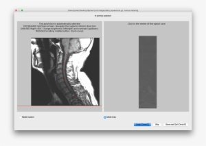 Results - Computed Tomography