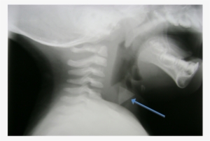 Medical Radiography