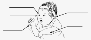 Free Photo Of Black Child With Down Syndrome Png - Mãos De Recem Nascido Com Síndrome De Down